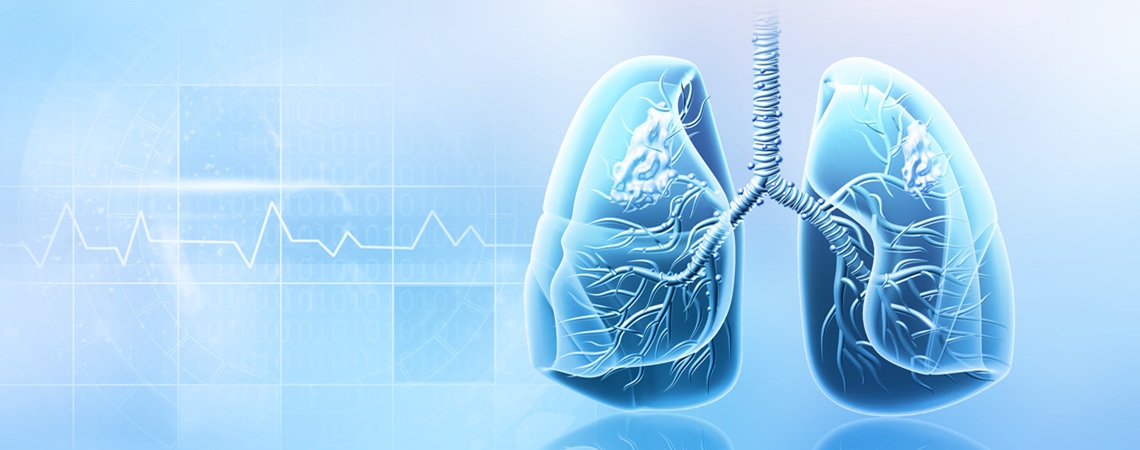 stilisiertes Bild beider Lungenflügel stilisiertes Bild beider Lungenflügel